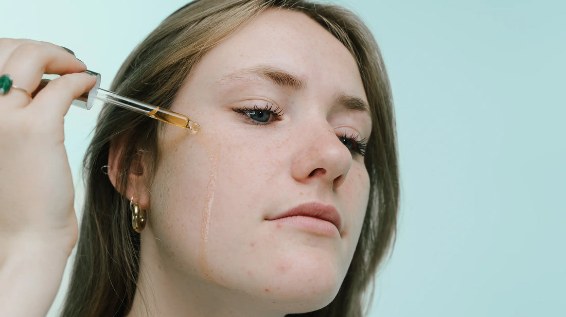 Skin Purging VS Break outs - Wat is het verschil | Puistjes - Mee-eters | Blog