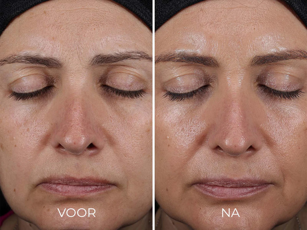 Image Skincare Daily Prevention Advanced Smartblend Mineral Moisturizer Spf 50 Before After