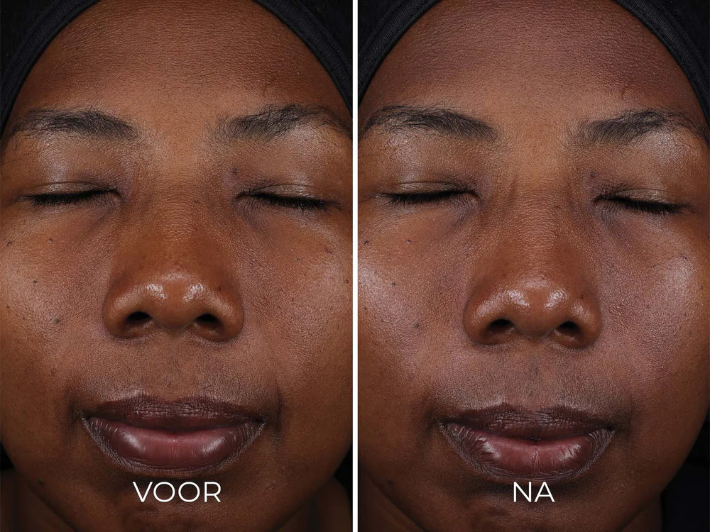 Image Skincare Daily Prevention Pure Mineral Tinted Moisturizer Spf 30 Before After