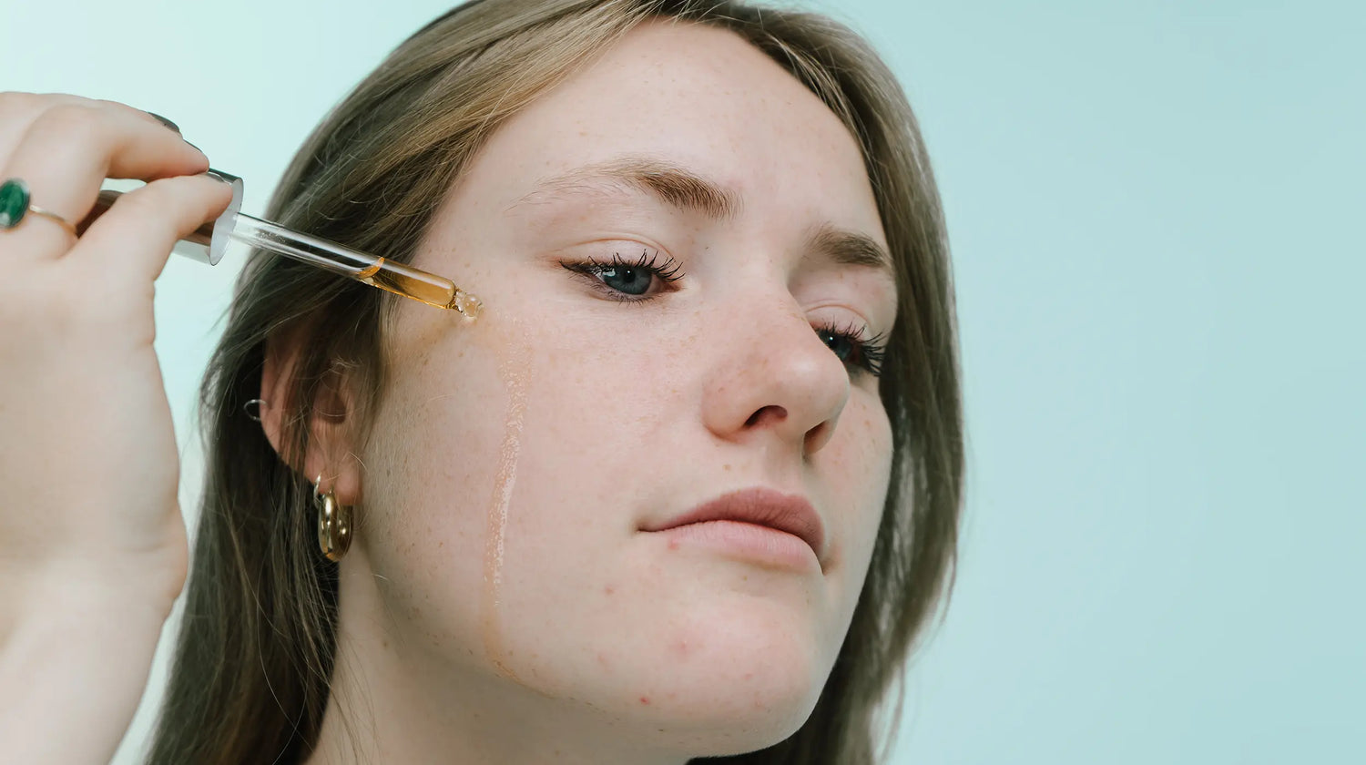 Skin Purging VS Break outs - Wat is het verschil | Puistjes - Mee-eters | Blog