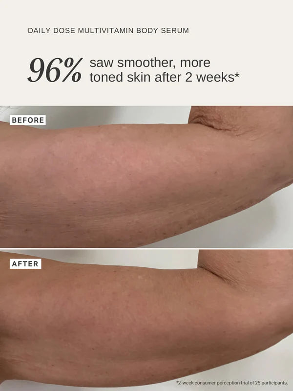 ALPHA-H Daily Dose Multi Vitamin Glow Body Serum Limited Edition Before After