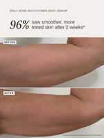 ALPHA-H Daily Dose Multi Vitamin Glow Body Serum Limited Edition Before After