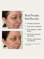 Alpha H Firming Collagen Repair Cream Before After