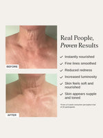 Alpha H Firming Peptide Body Oil Before After