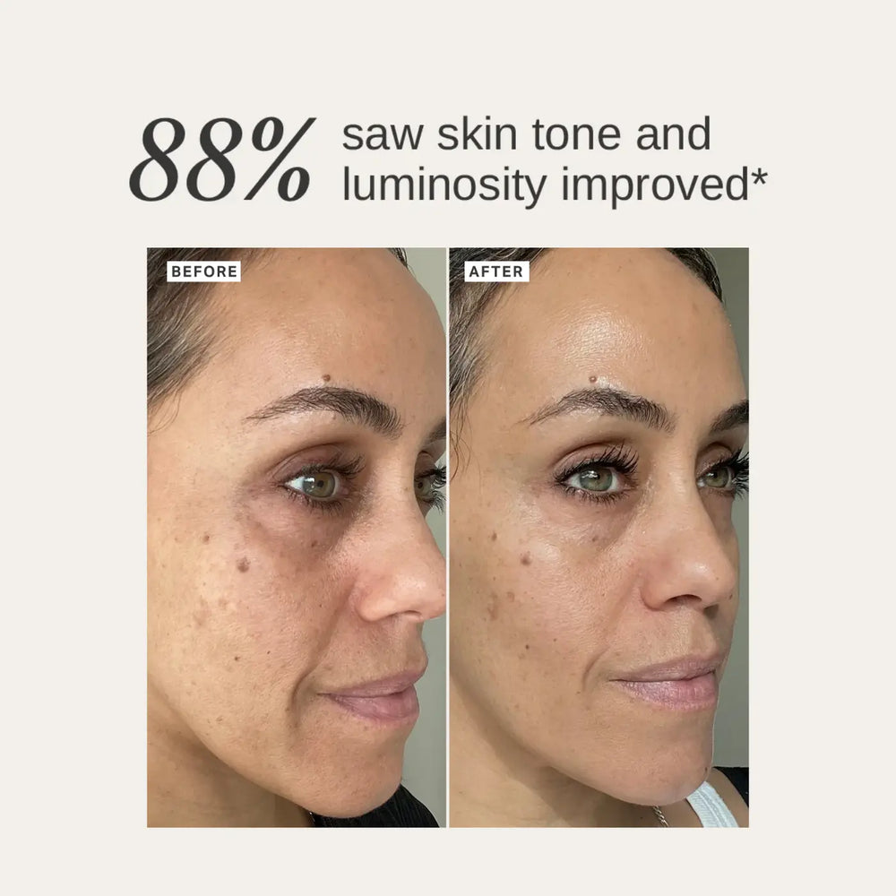 ALPHA-H Liquid Gold Limited Edition Travelsize Before and After