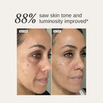 ALPHA-H Liquid Gold Limited Edition Travelsize Before and After