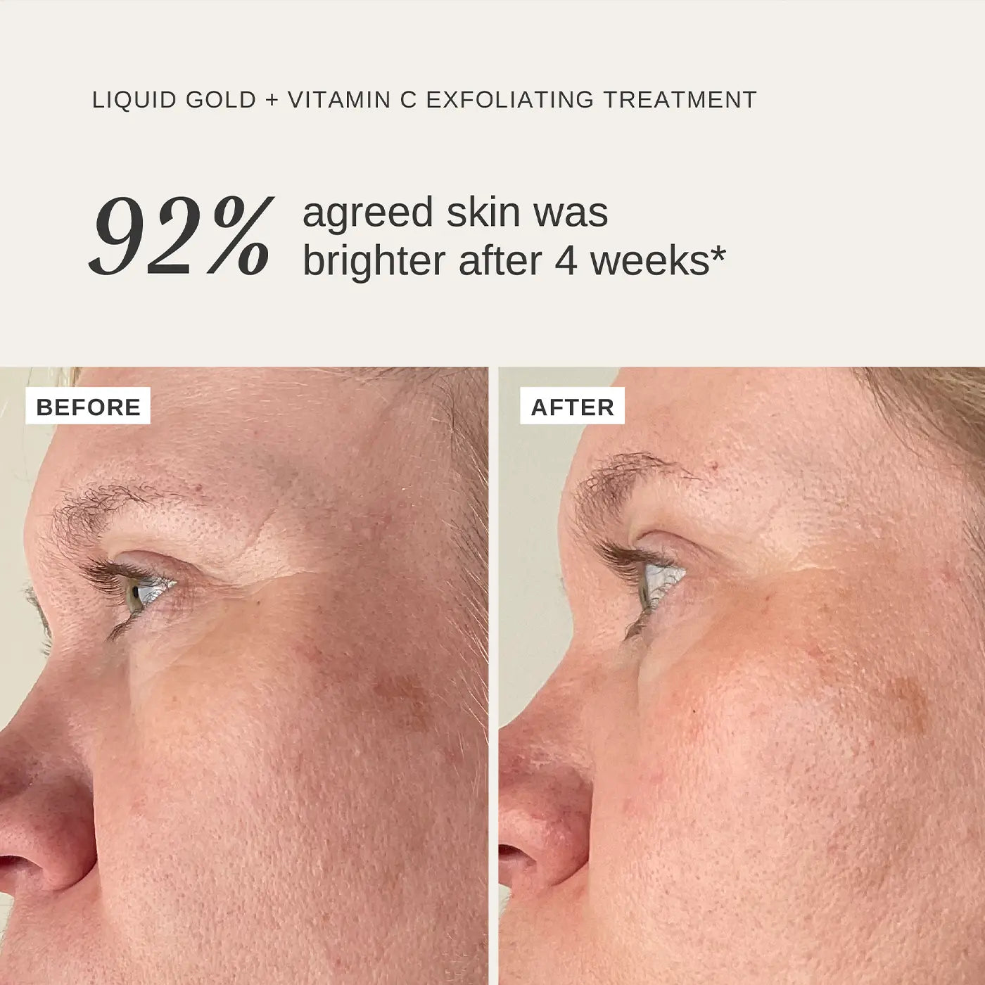 ALPHA-H - Liquid Gold + Vitamin C