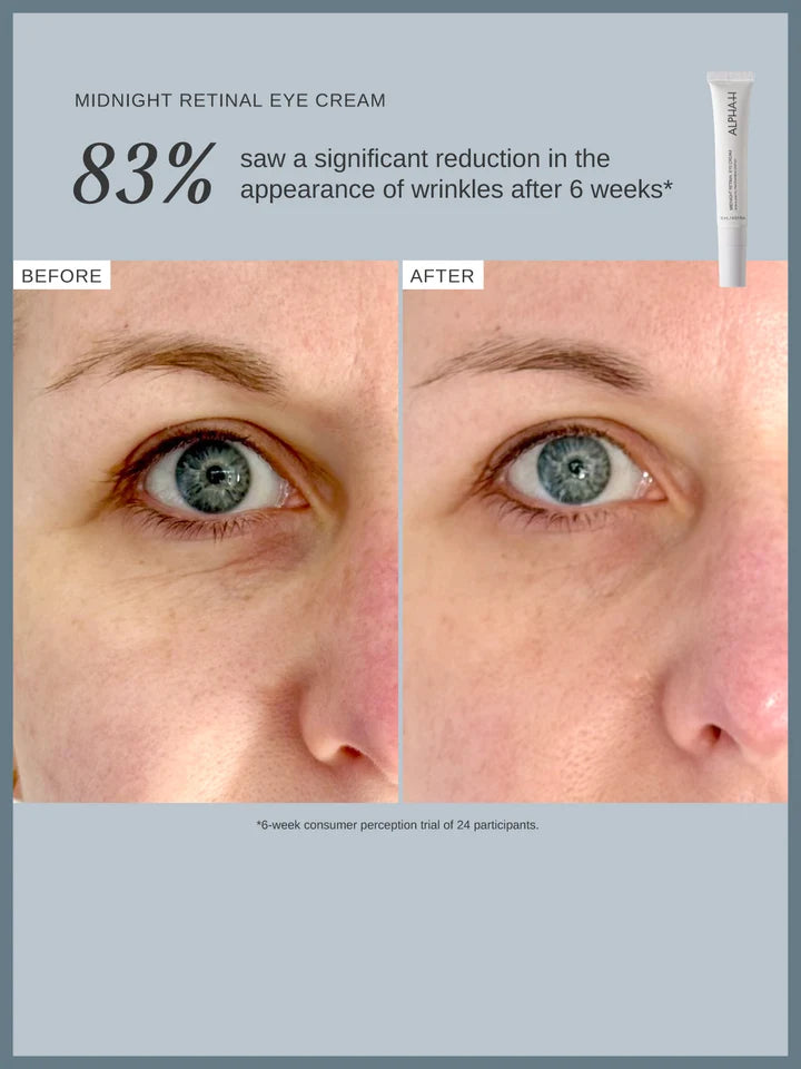 ALPHA-H Midnight Retinal Eye Before After