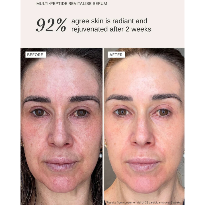 ALPHA-H Multi Peptide Revitalise Serum Before After