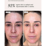 ALPHA-H Multi Peptide Revitalise Serum Before After