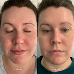 ALPHA-H Vitamin A Serum Before After