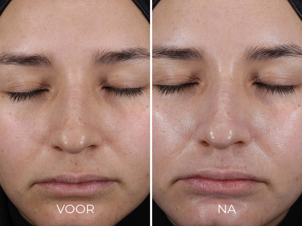 Image Skincare Daily Prevention Pure Mineral Hydrating Moisturizer Spf 30 Before After