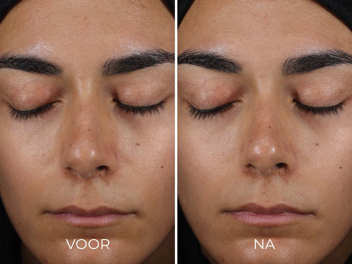 Image Skincare - DAILY PREVENTION - Sheer Matte Moisturizer SPF 30