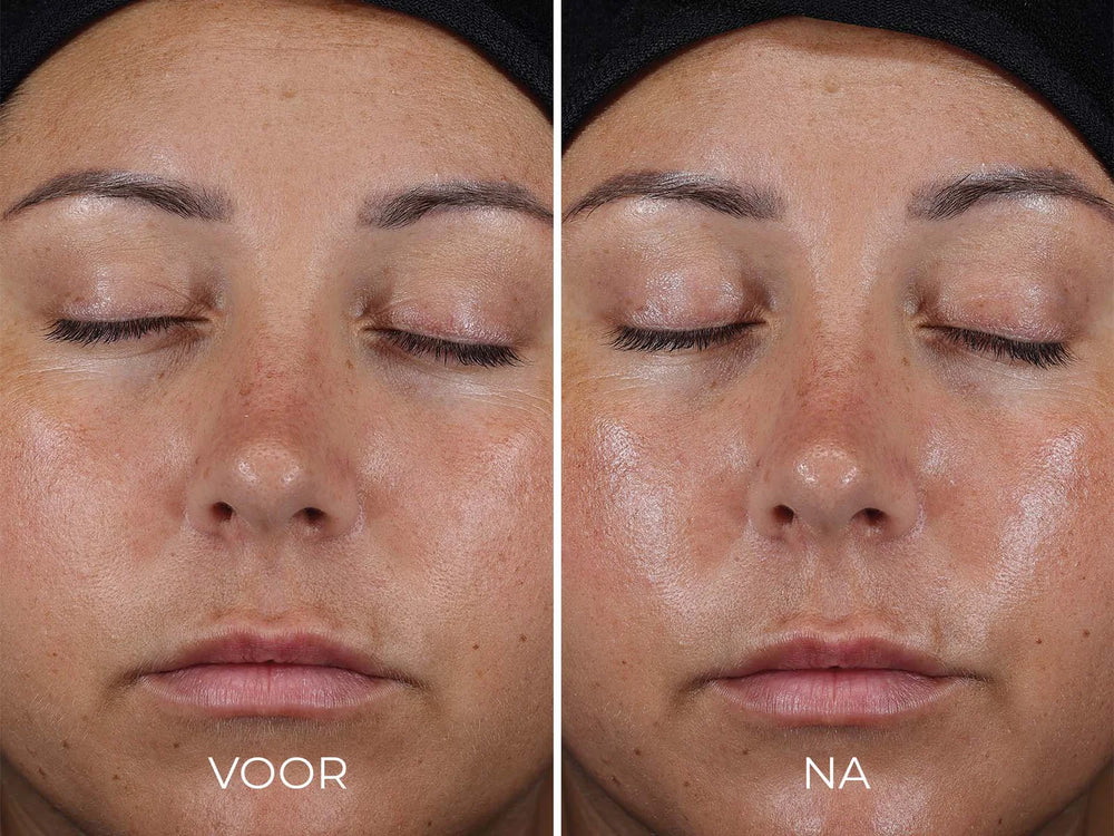 Image Skincare Daily Prevention Ultra Defense Moisturizer Spf 50 Before After