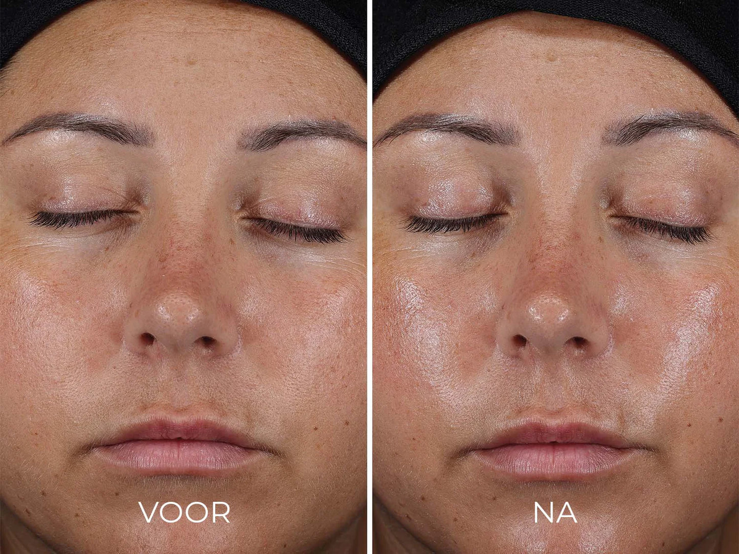 Image Skincare - DAILY PREVENTION - Ultra Defense Moisturizer SPF 50