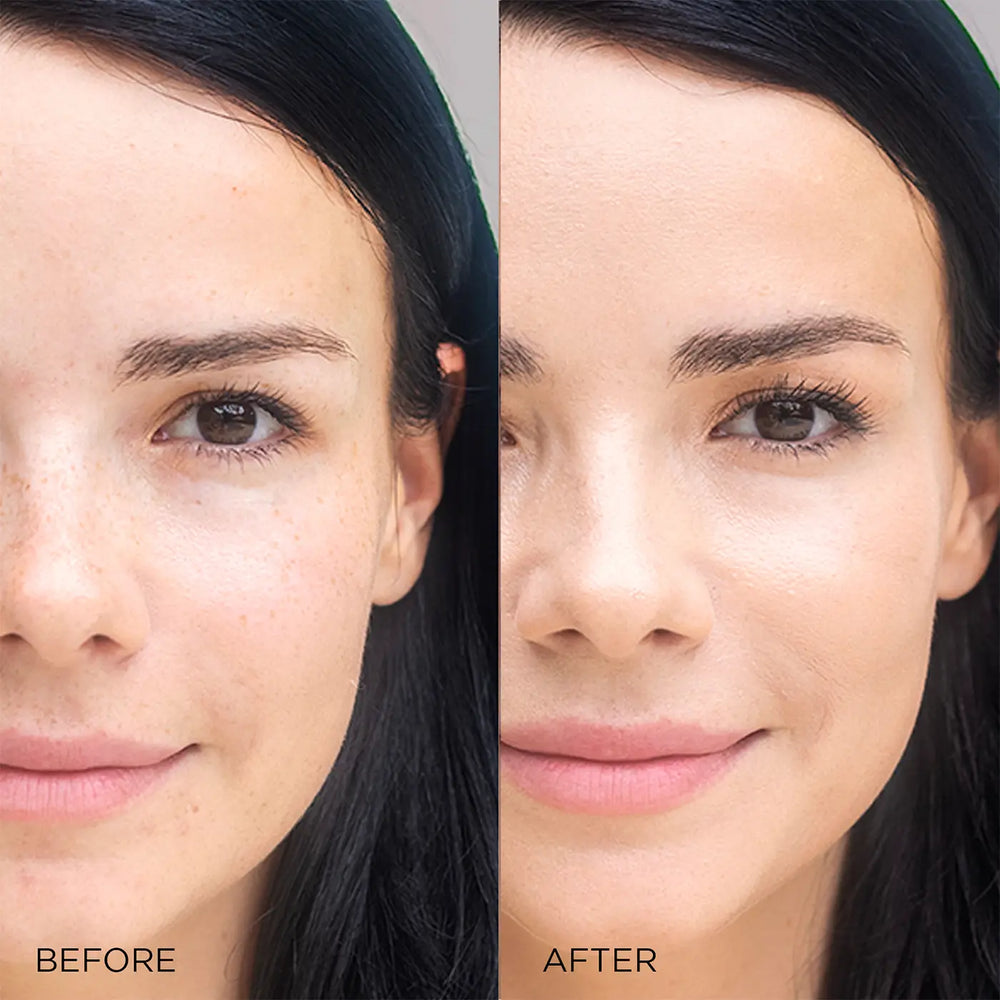 Image Skincare I Beauty I Conceal Flawless Foundation Natural Before After