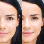 Image Skincare I Beauty I Conceal Flawless Foundation Natural Before After