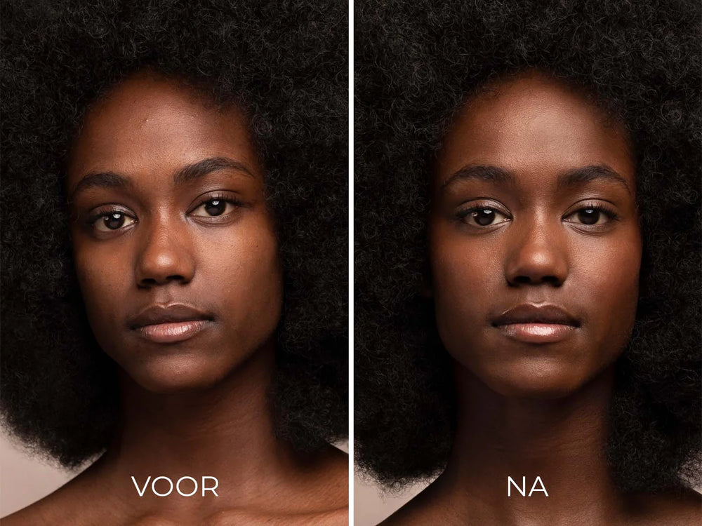 Image Skincare Prevention Clear Solar Gel Before After