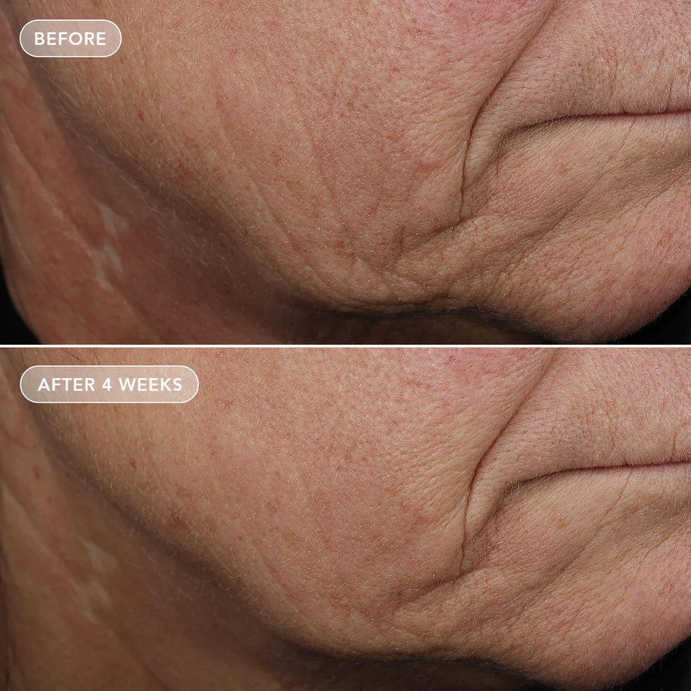 Image Skincare VOLULIFT 4D Skin Rebound Complex Before After 1