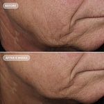 Image Skincare VOLULIFT 4D Skin Rebound Complex Before After 1