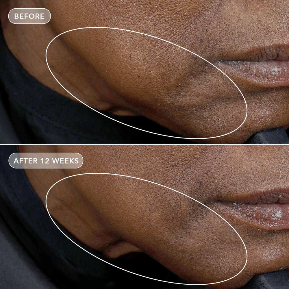 Image Skincare VOLULIFT 4D Skin Rebound Complex Before After 2