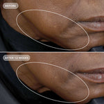 Image Skincare VOLULIFT 4D Skin Rebound Complex Before After 2