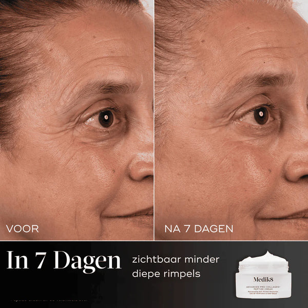 Medik8 Advanced Pro Collagen Plus Peptide Cream Before After