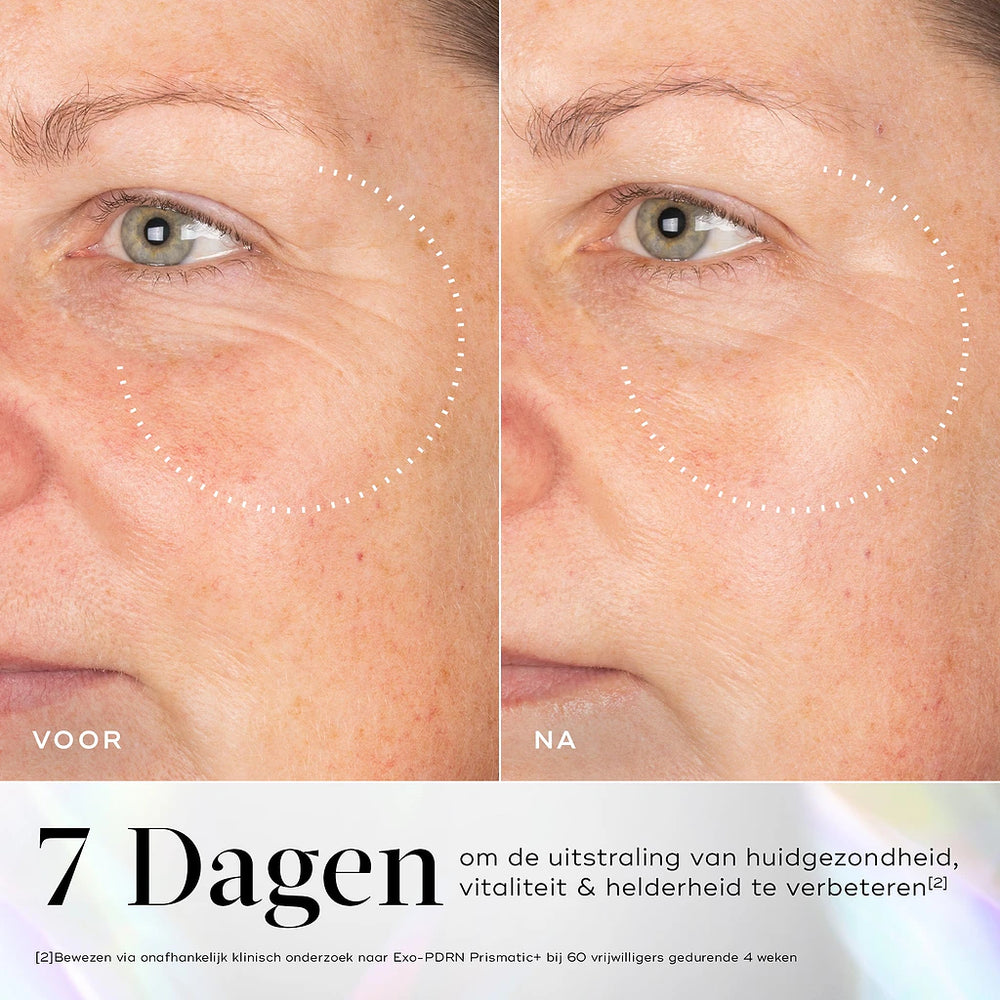 Medik8 Exo-PDRN Prismatic Before After 2