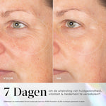 Medik8 Exo-PDRN Prismatic Before After 2