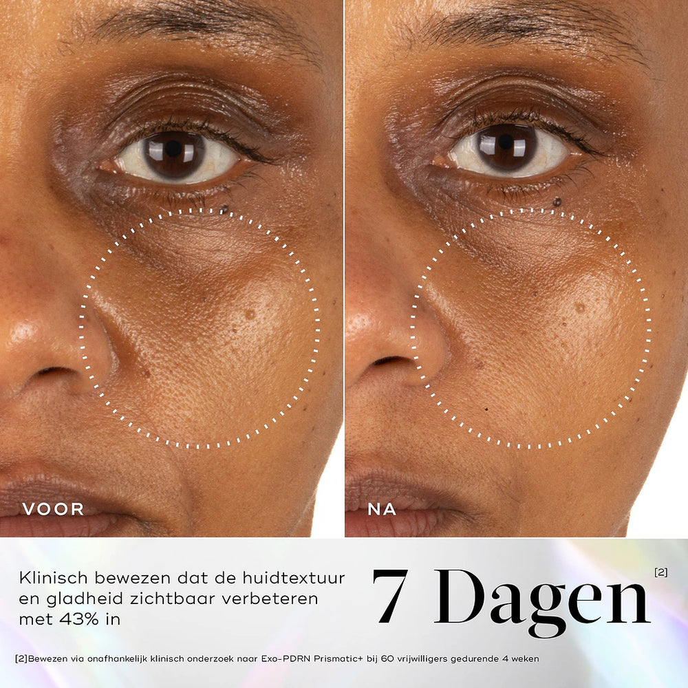 Medik8 Exo-PDRN Prismatic Before After 3
