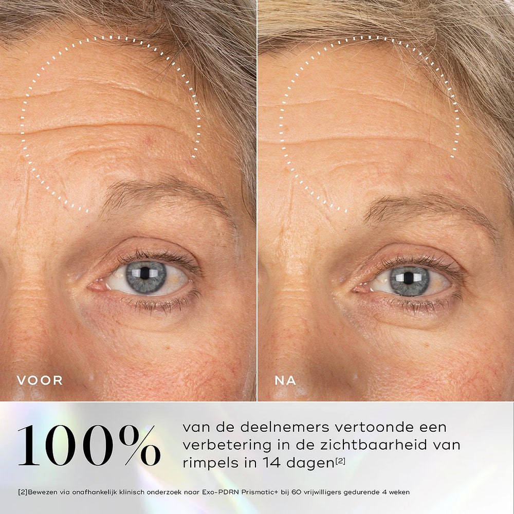 Medik8 Exo-PDRN Prismatic Before After
