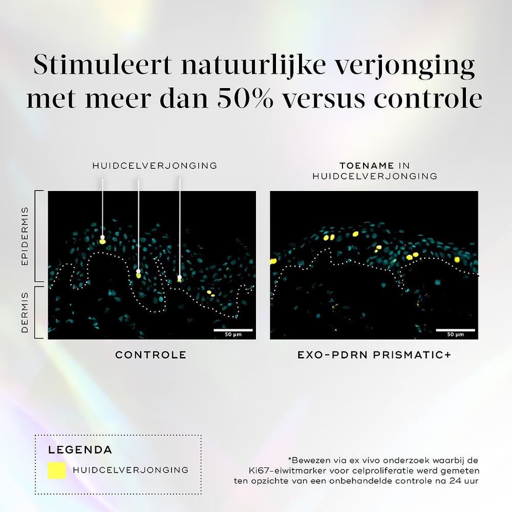 Medik8 Exo-PDRN Prismatic Regeneration Study