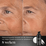 Medik8 Liquid Peptides Advanced Mp Before After Kraaienpootjes