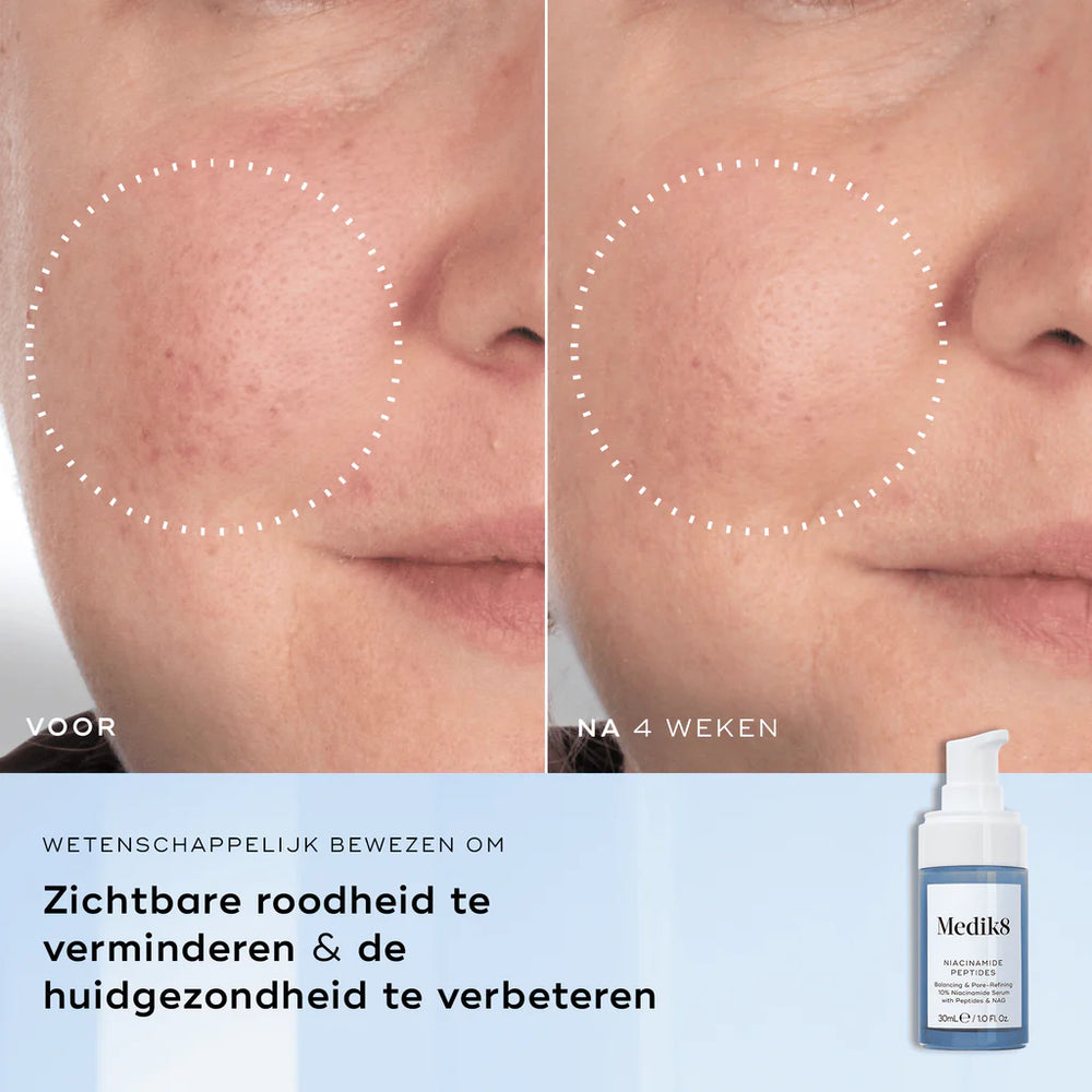 Medik8 Niacinamide Peptides Before After
