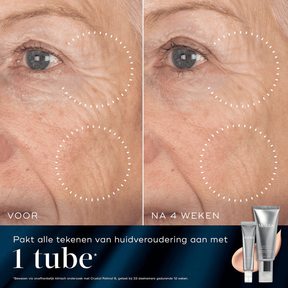 Medik8 Retinal Rewind Before After