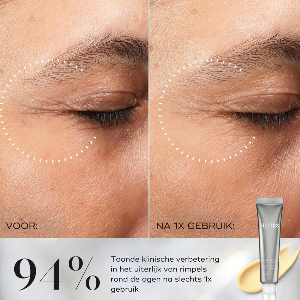 Medik8 Skincare Crystal Retinal Ceramide Eye 3 Before After