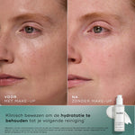 Medik8 Total Moisture Daily Cleansing Gel Before After