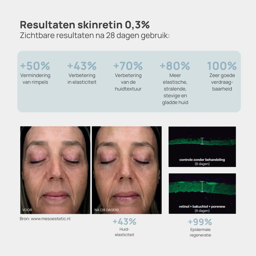Mesoestetic Anti-Aging Duo Resultaten