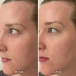 ALPHA-H - Liquid Gold Midnight Reboot Serum - Before - After