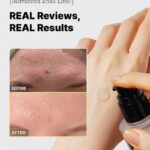 COSRX - advanced snail 96 mucin power essence - Before after