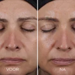 Image Skincare - Daily Prevention - Avanced Smartblend Mineral Moisturizer - SPF50 - Vergelijking