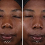 Image Skincare - Daily Prevention - Pure Mineral Tinted Moisturizer - SPF30 - Vergelijking