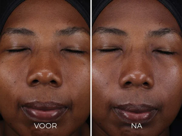 Image Skincare - Daily Prevention - Pure Mineral Tinted Moisturizer - SPF30 - Vergelijking
