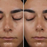 Image Skincare - Daily Prevention - Sheer Matte Moisturizer - SPF30 - Vergelijking