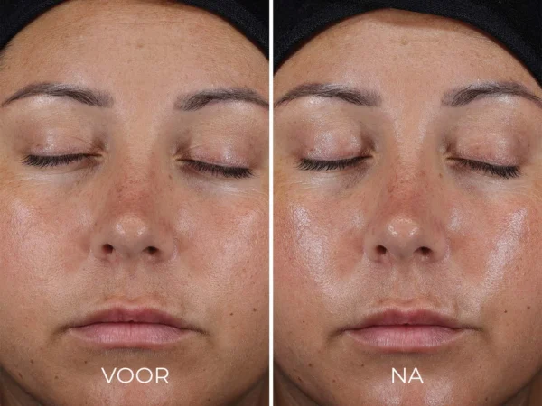 Image Skincare - Daily Prevention - Ultra Defense Moisturizer - SPF50 - Vergelijking